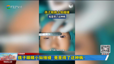 东南视界：孩子眼睛小如细缝 竟是得了这种病！