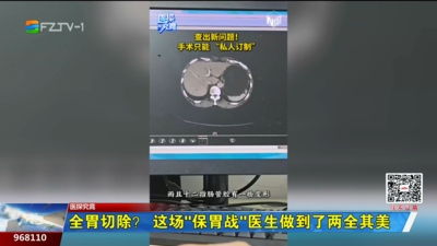 全胃切除？ 这场“保胃战”医生做到了两全其美