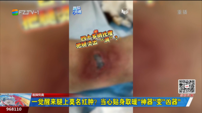 一觉醒来腿上莫名红肿？当心贴身取暖“神器”变“凶器”