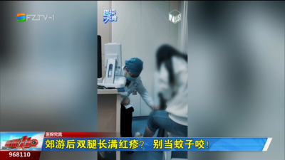 医探究竟：郊游后双腿长满红疹？别当蚊子咬！