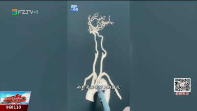医探究竟：主动脉长瘤、脑血管错位 这台手术如何破局？
