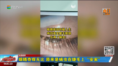 东南视界：眼睛奇痒无比 原来是螨虫在睫毛上“安家”