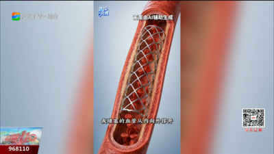 小小支架如何撑开堵塞血管？全过程揭秘
