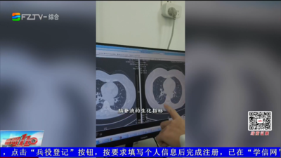 养鸟咳嗽别硬扛！警惕隐球菌“侵肺入脑”